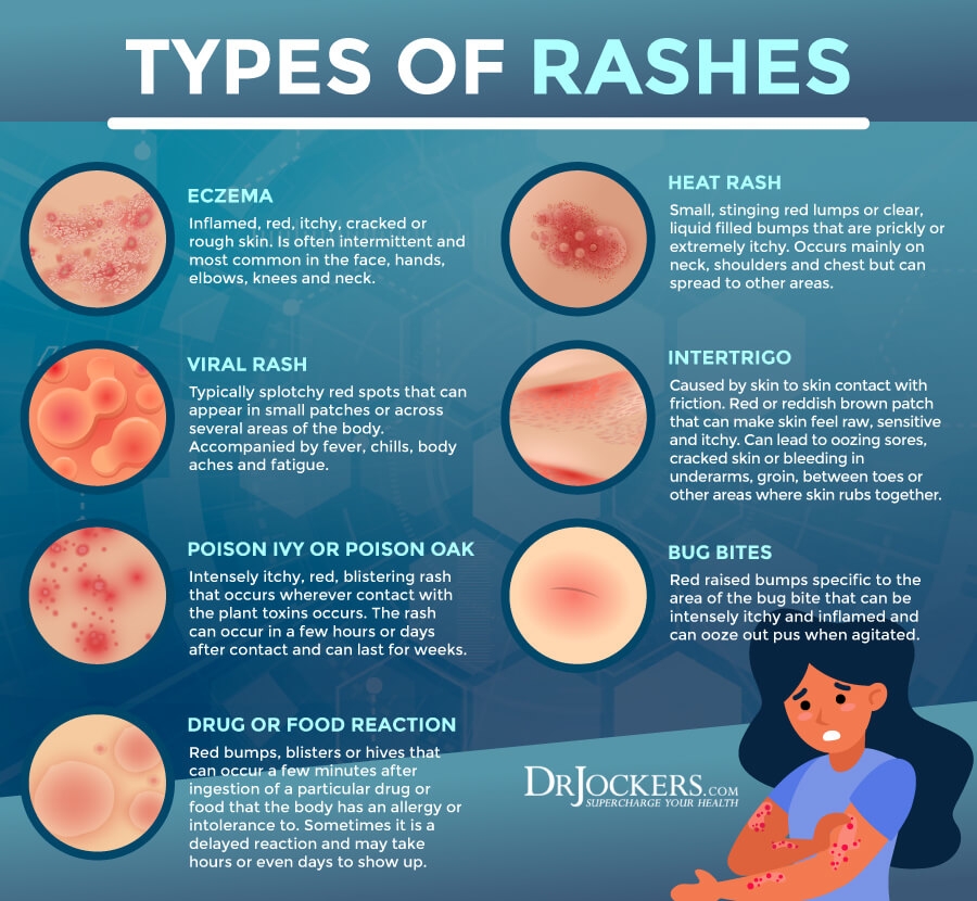 Decoding Your Rash A Complete Information To Figuring Out Pores And 