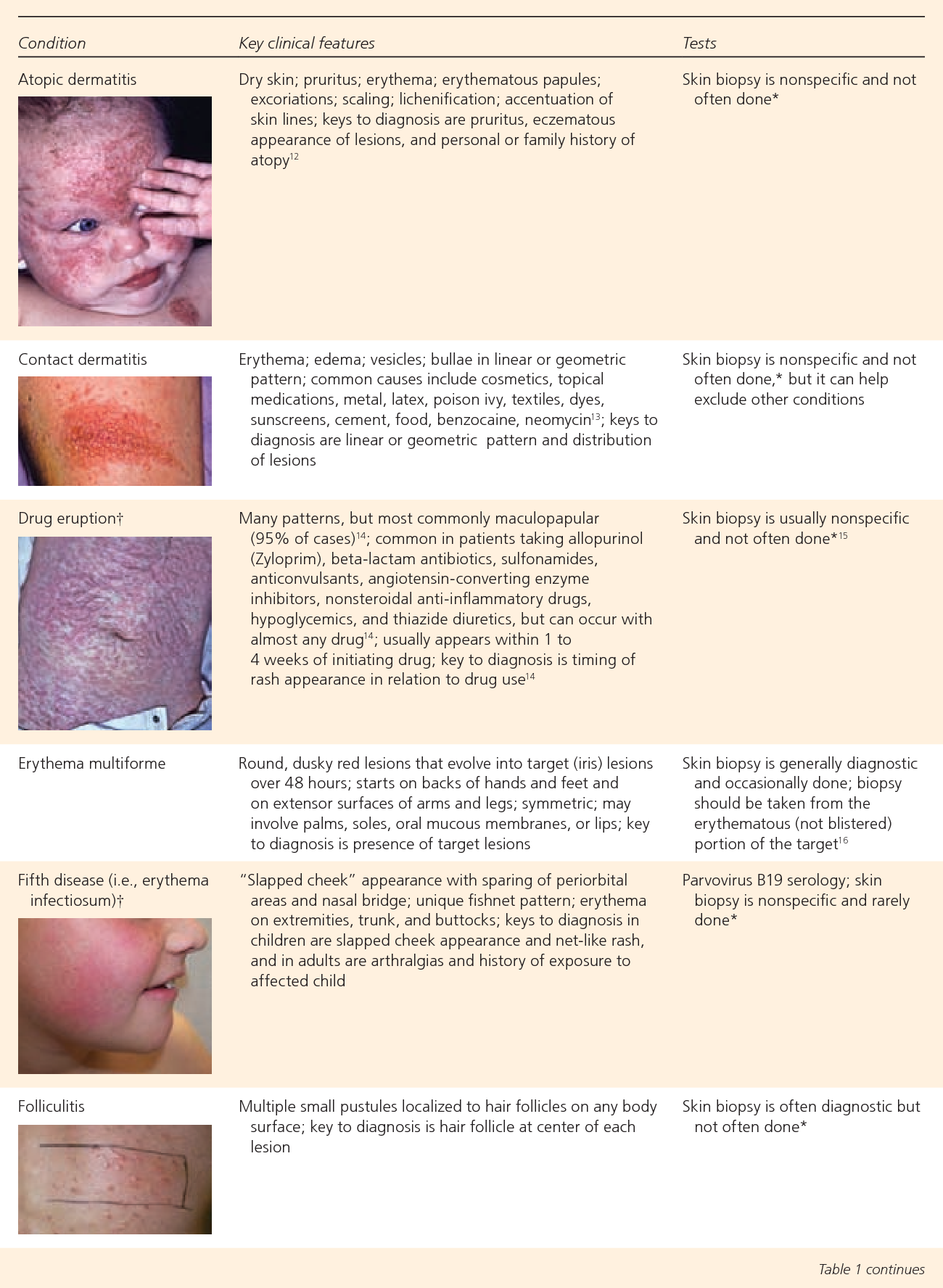 How To Describe A Rash Dermatology At Francisco Sanderson Blog