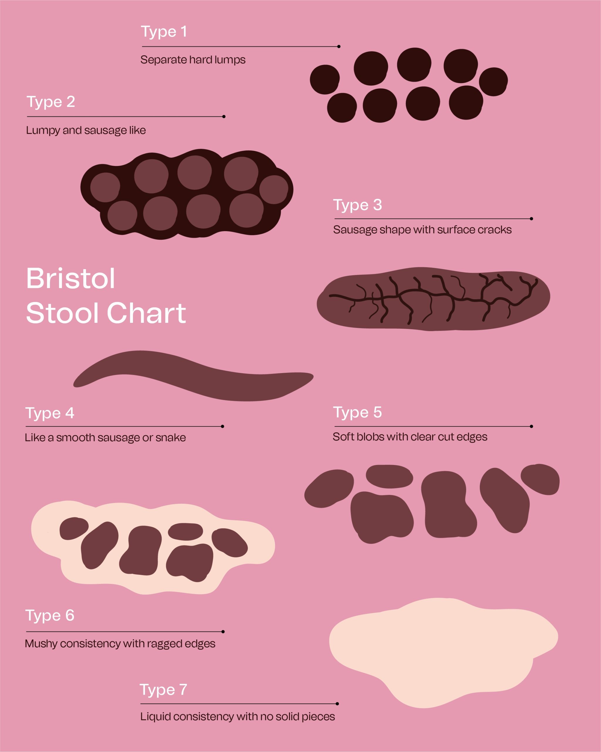 Ibs Stool
