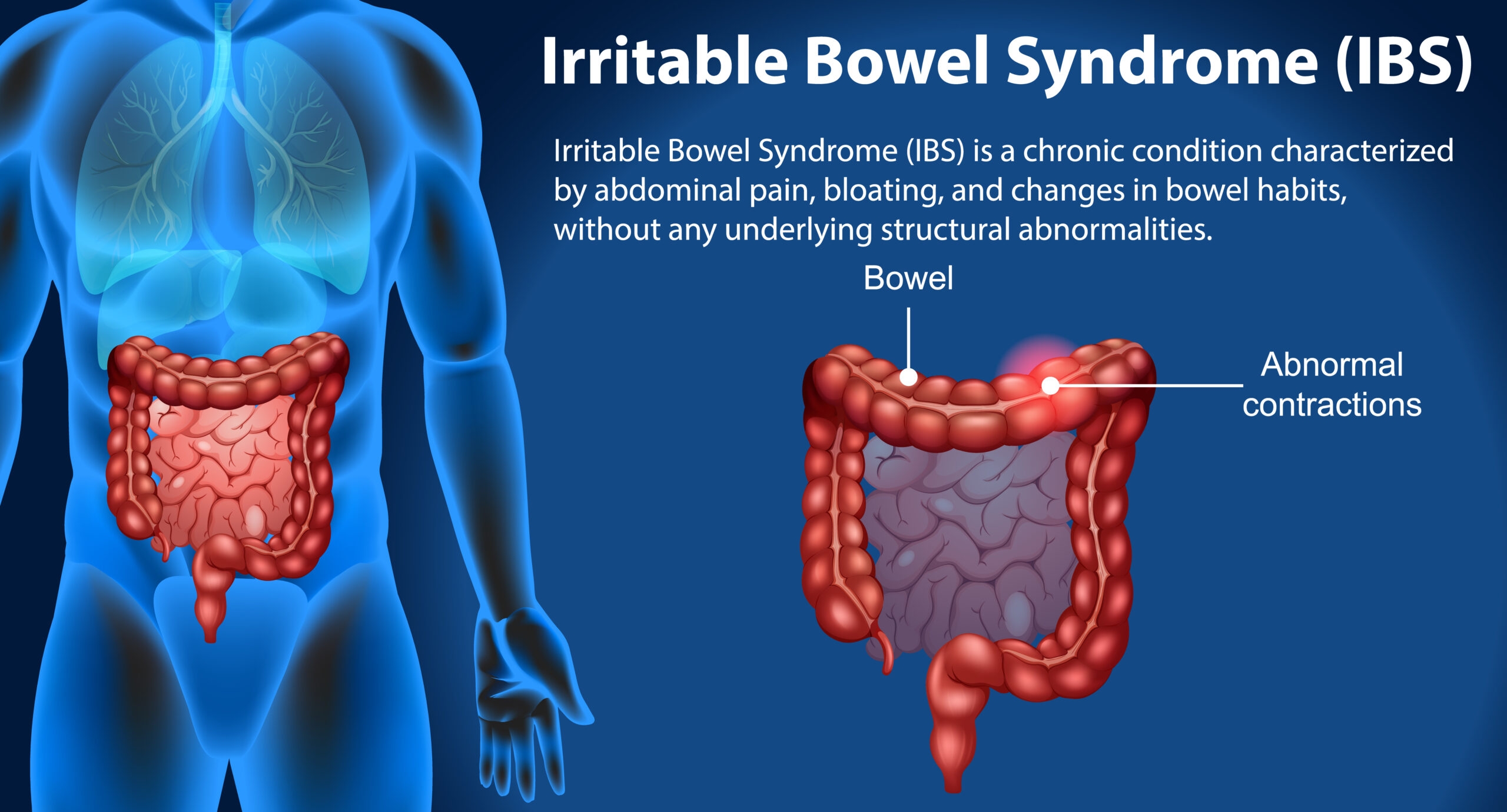 Irritable Bowel Symptoms What Is IBS Or Irritable Bowel Syndrome 