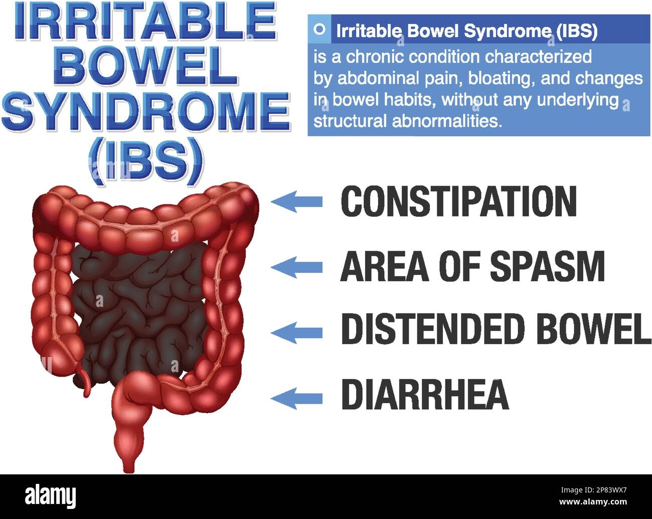 ibs diet chart ibs diet chart
