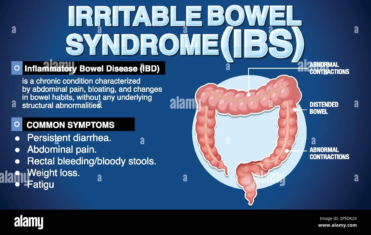 Irritable Bowel Syndrome X Ray At Alison Mclemore Blog