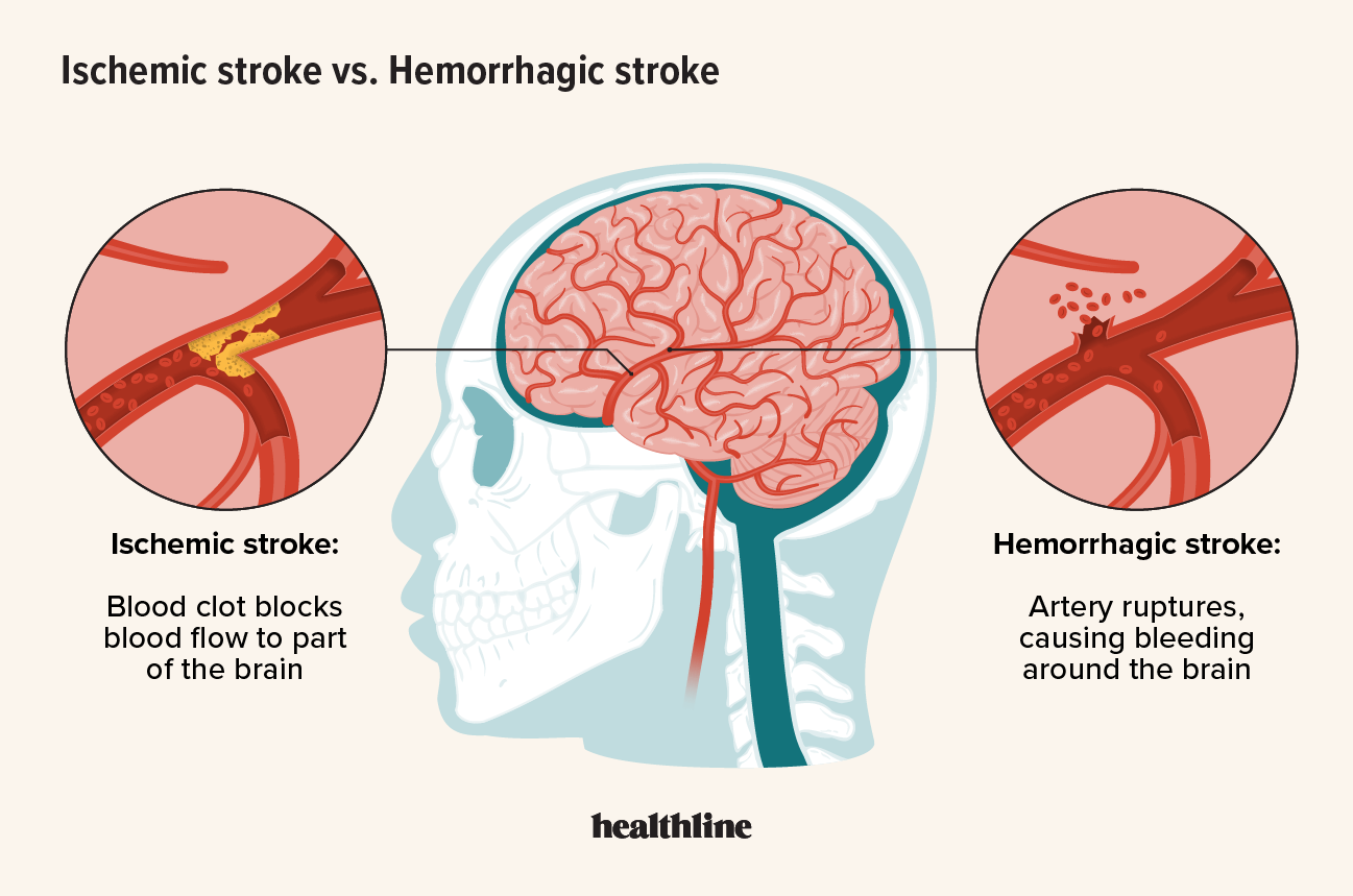 stroke and coat color chart stroke and coat color chart