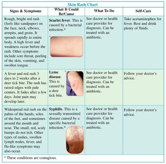 Rash Types Chart A Visual Reference Of Charts Chart Master