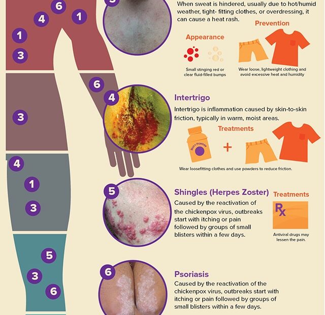 Skin Rashes In Children
