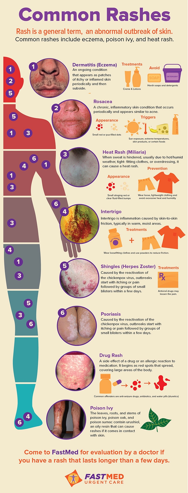 Skin Rashes In Children Skin Rashes In Children