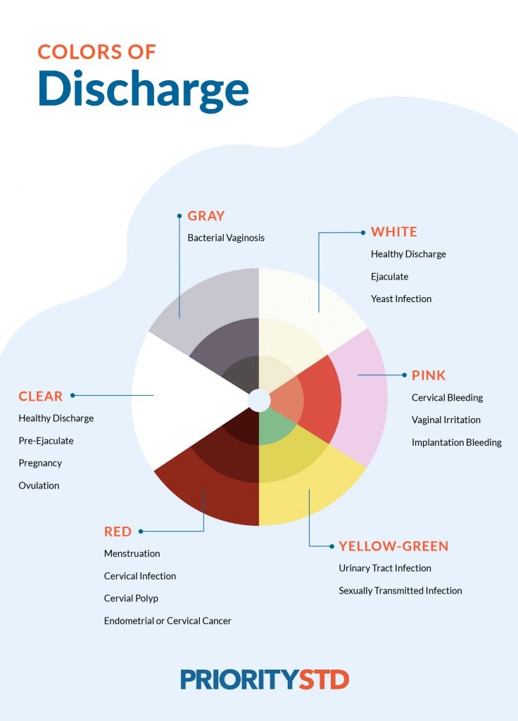 discharge color chart