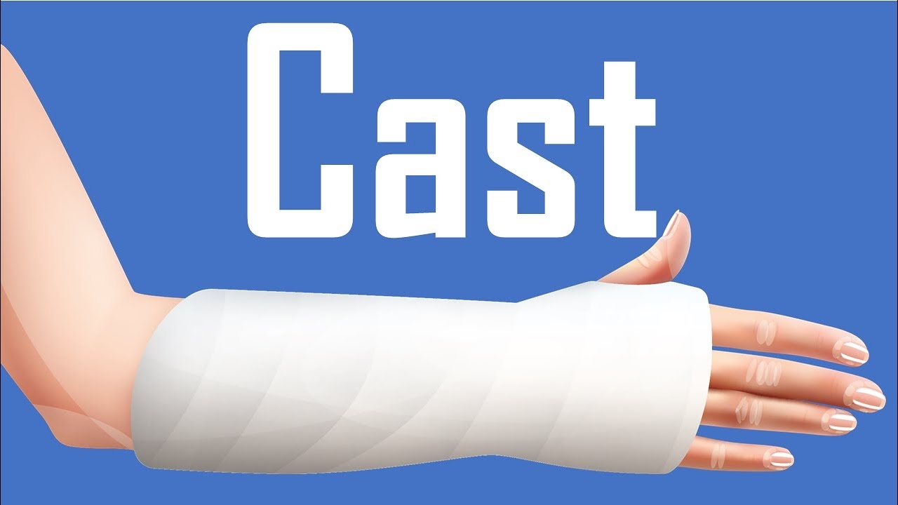 The Cast Definition Purposes Types Complications Intervention 