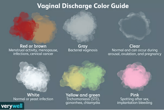 Vaginal Discharge Color Chart