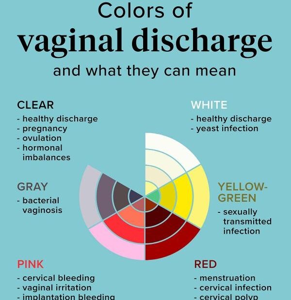 Vaginal Discharge Color Guide What To Know