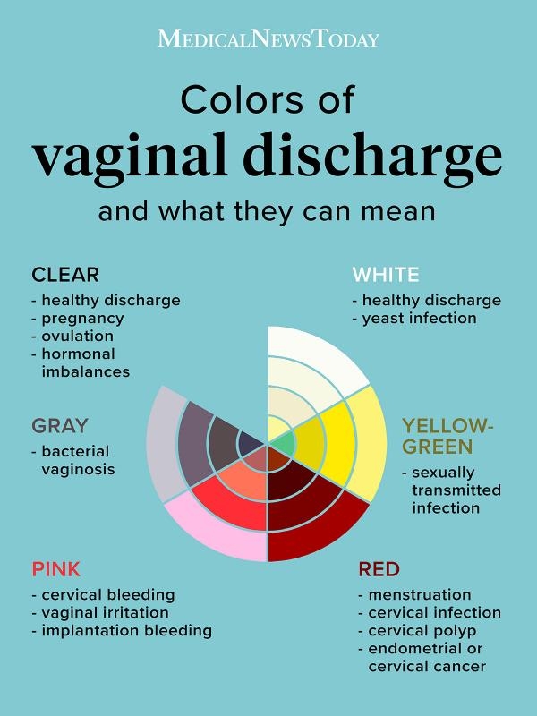 Vaginal Discharge Color Guide What To Know